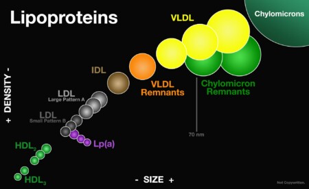 Lipoprotein Size vs Density Graph - Chylomicrons, VLDL, IDL, LDL Large Pattern A, LDL Small Pattern B, HDL and Lp(a) Particles